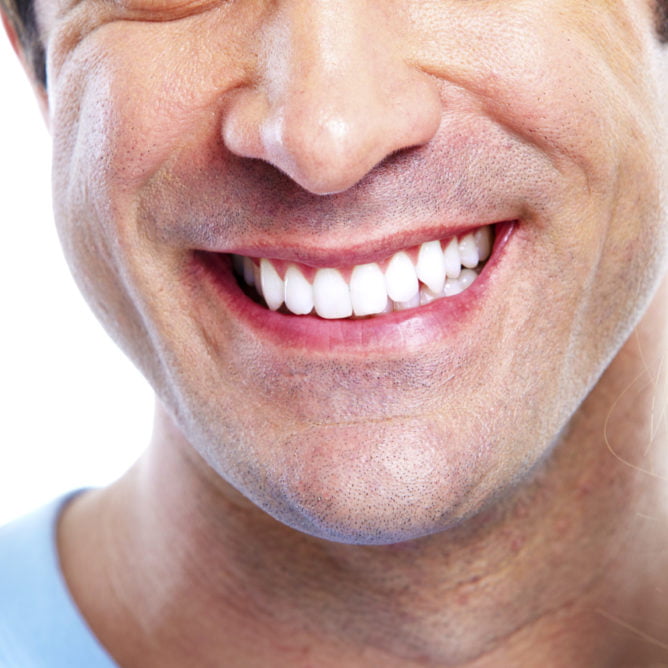 blanqueamiento-dental-para-hombre.jpg